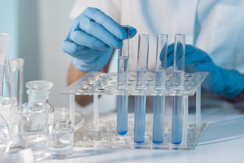 مستلزمات التحاليل والمختبرات